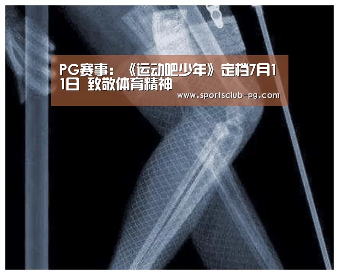 PG视讯